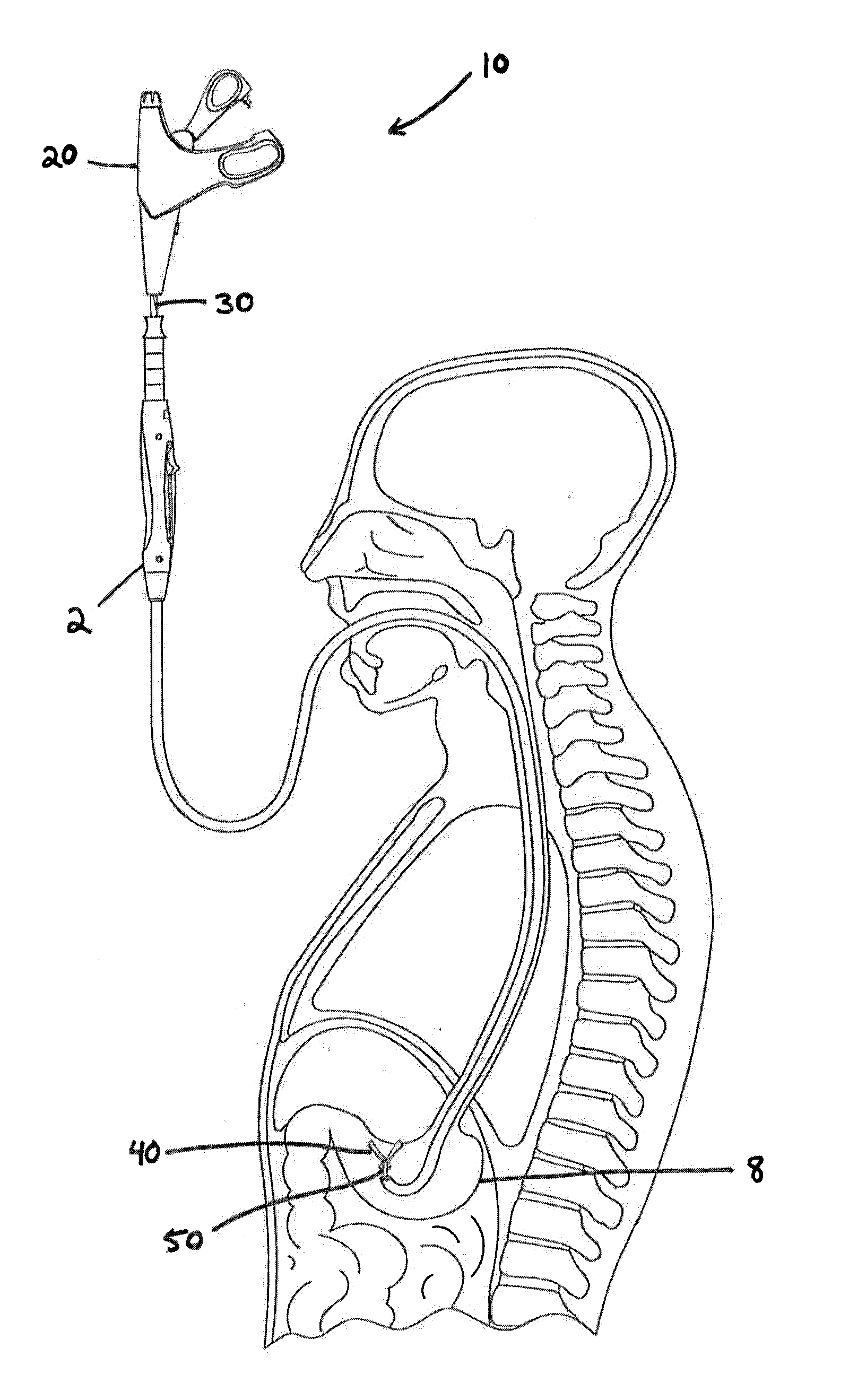 Vibratory motor use