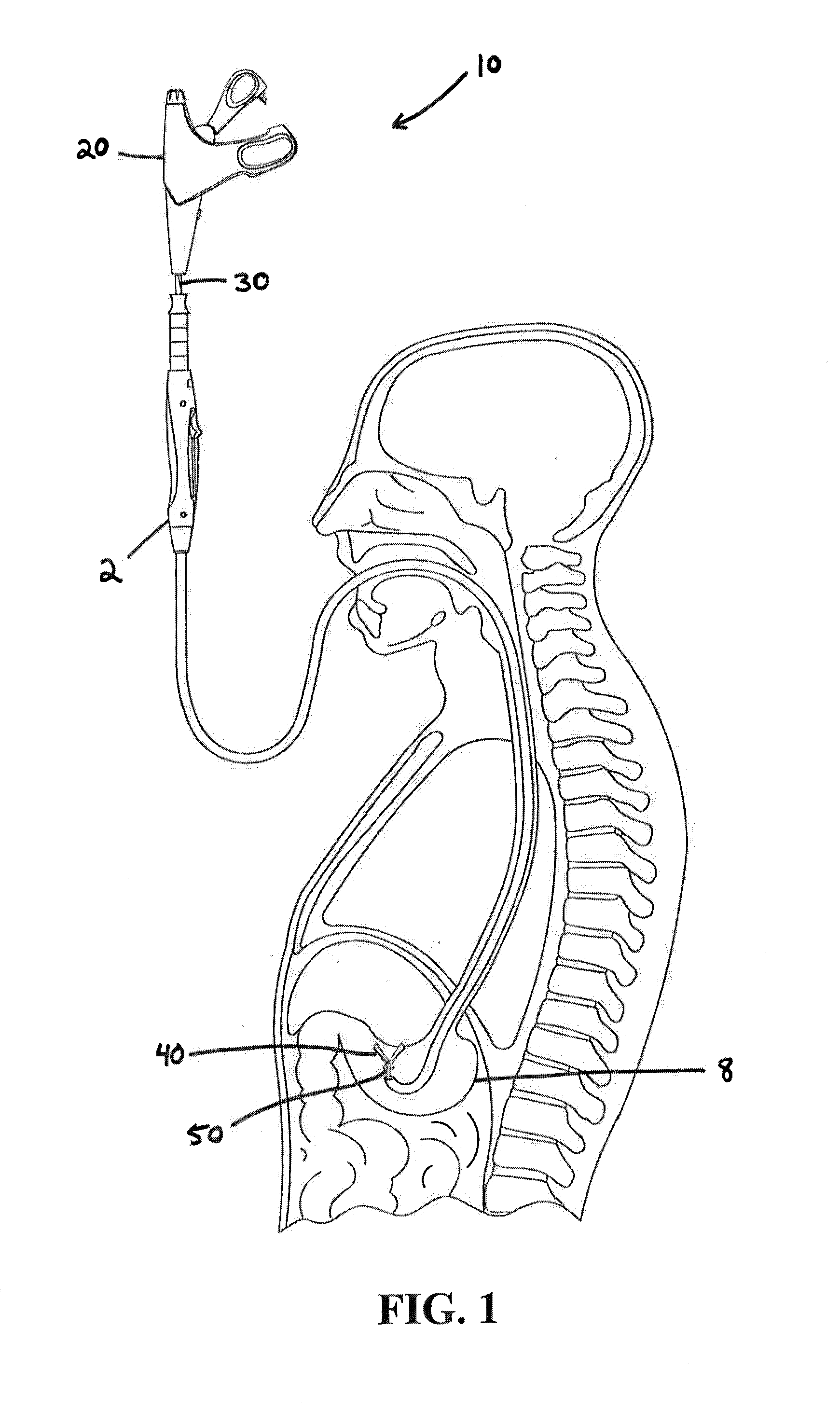 Vibratory motor use