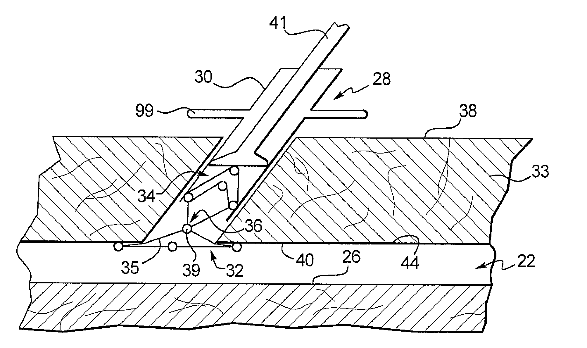 Apparatus and Method for Closing an Opening in a Blood Vessel Using a Permanent Implant