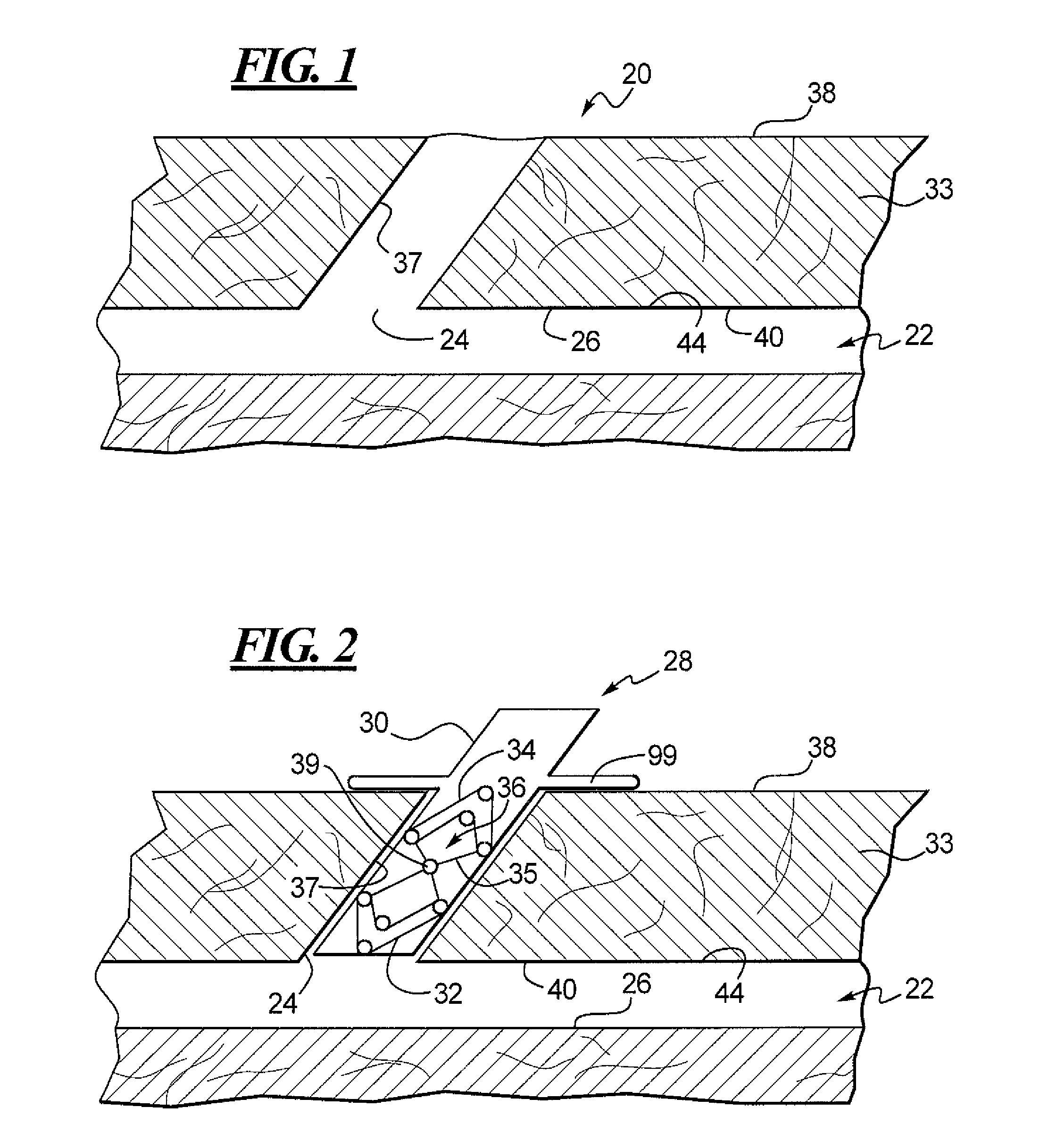 Apparatus and Method for Closing an Opening in a Blood Vessel Using a Permanent Implant