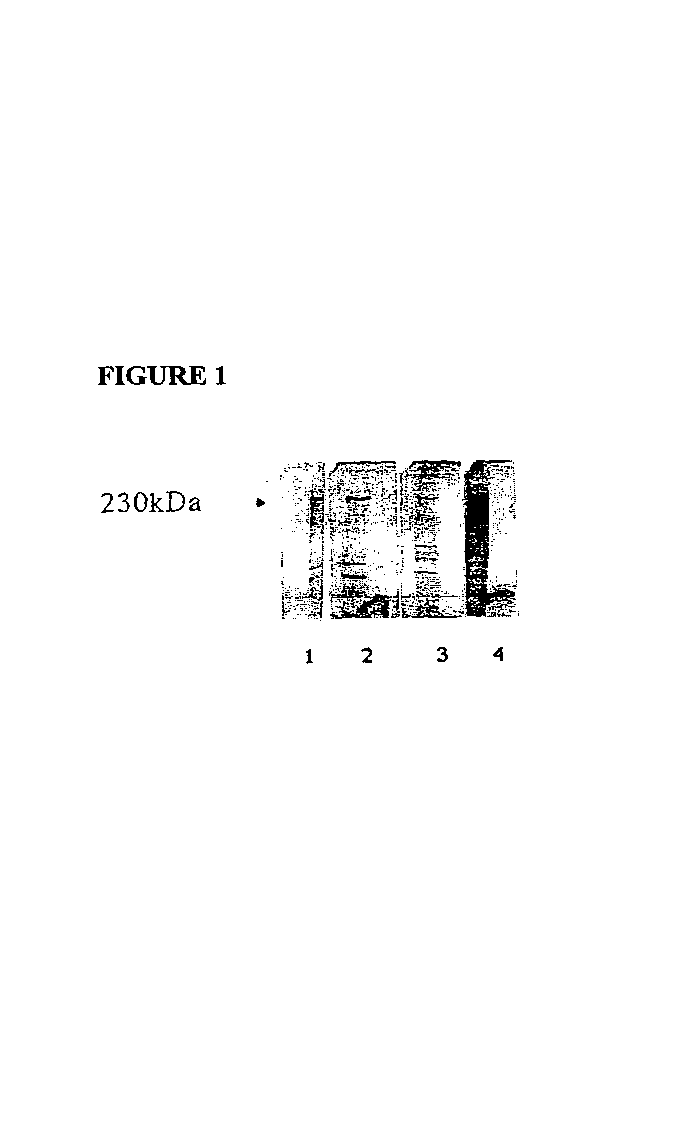 Nucleic acids encoding a recombinant 250 kDa antigen from sporozoites/merozoites of Eimeria maxima and their uses