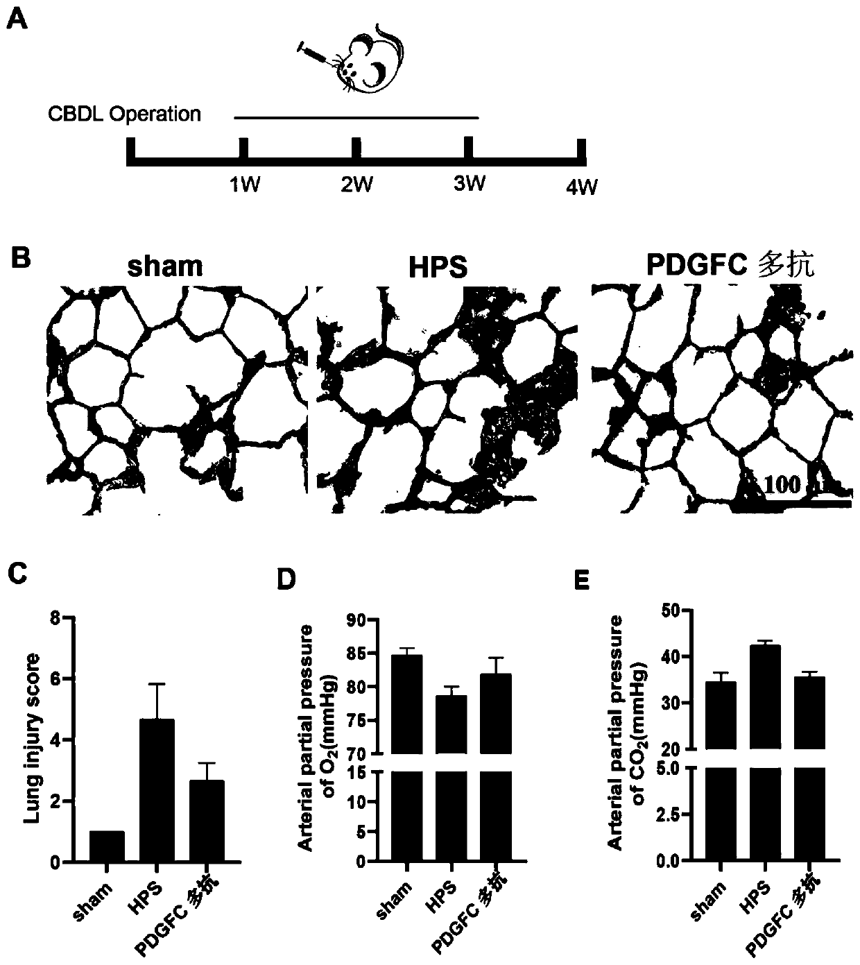 Application of pro-angiogenic factor PDGFC as marker for diagnosis and treatment of hepatopulmonary syndrome