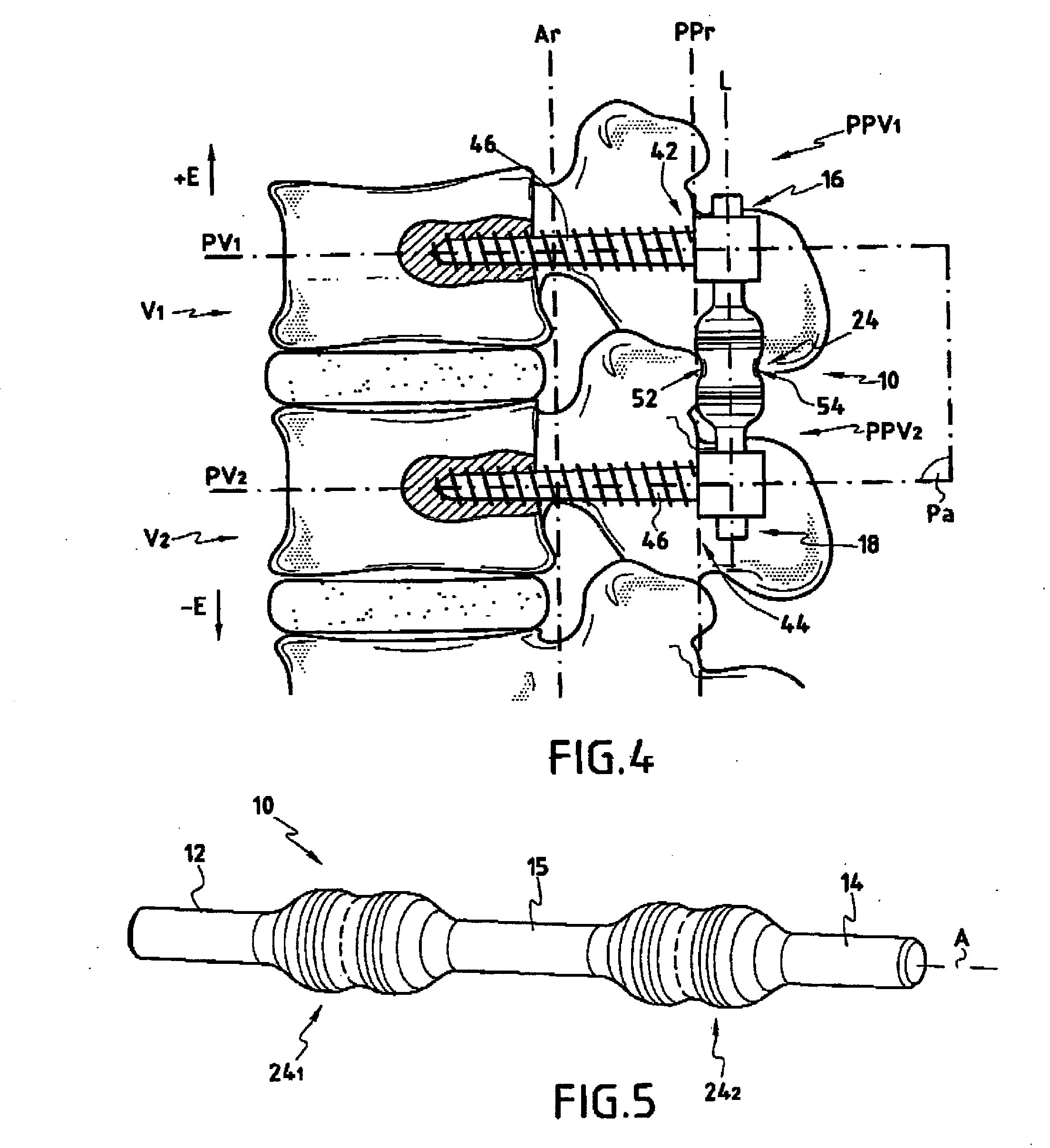 Flexible linking piece for stabilising the spine