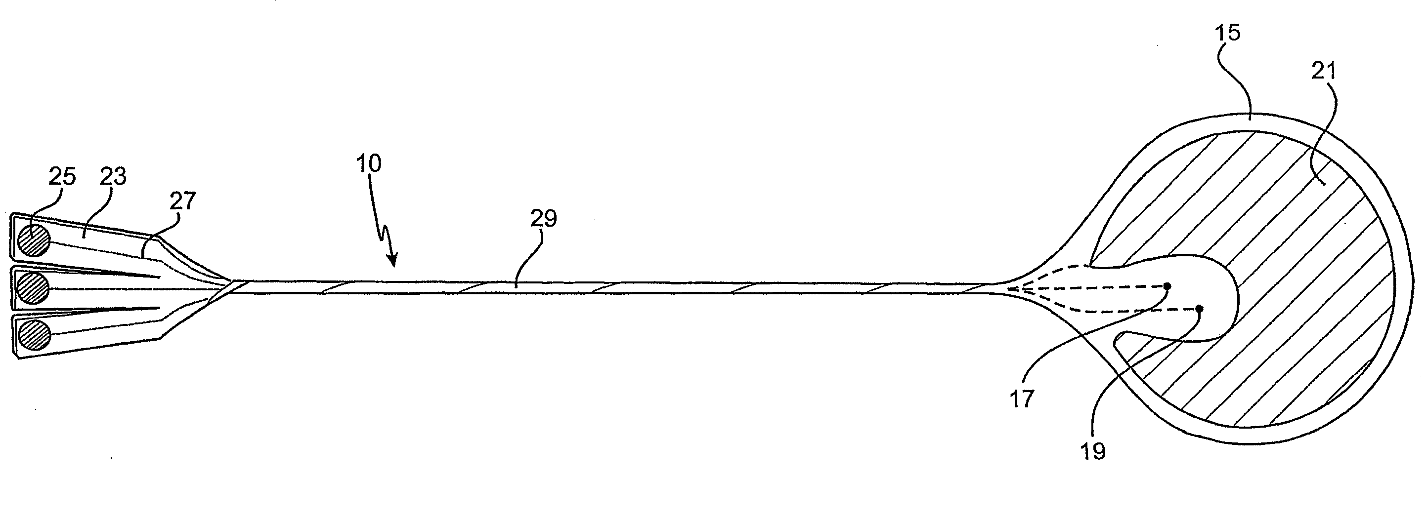 Cardiac stimulation apparatus