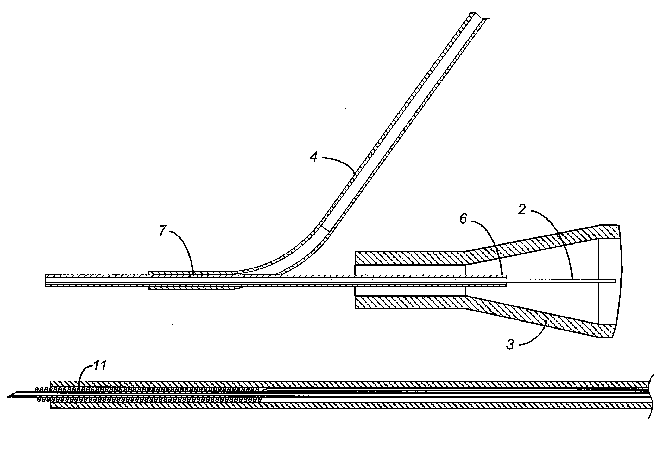 Subretinal access device