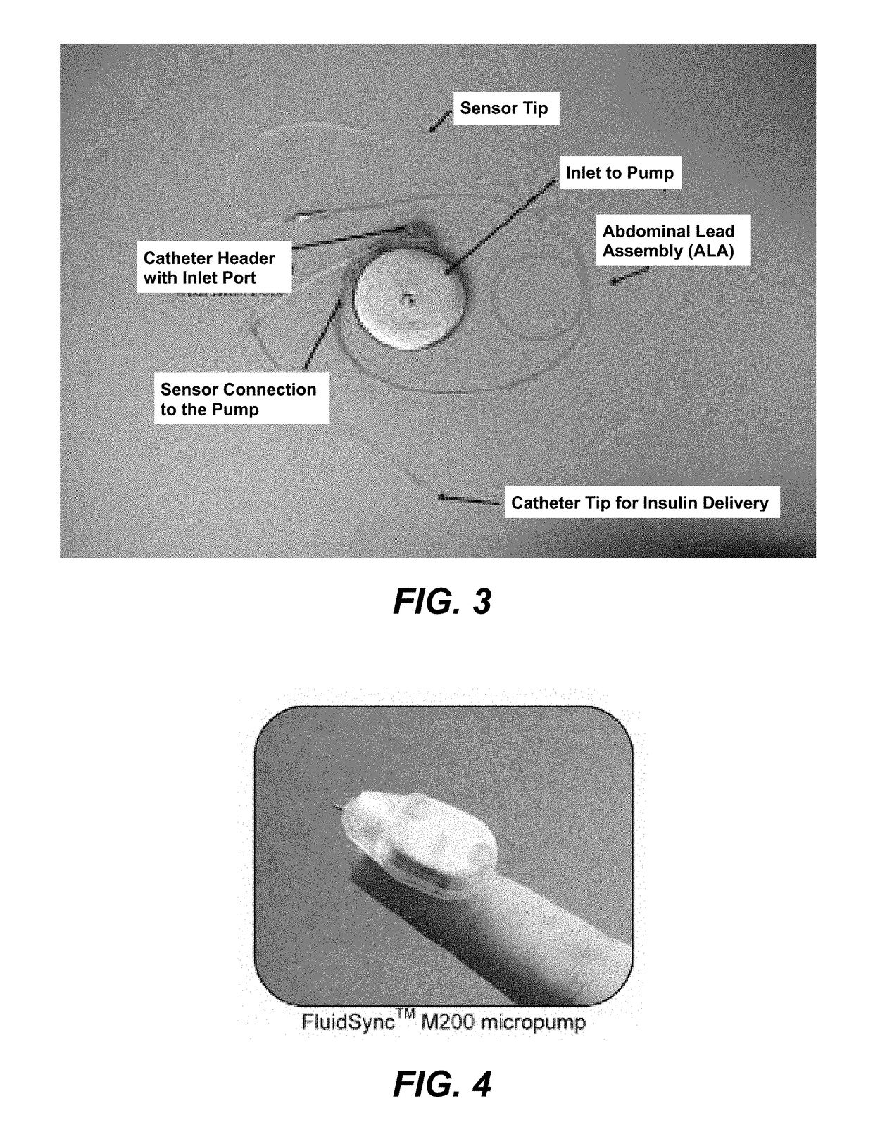 System and method for treating inflammation