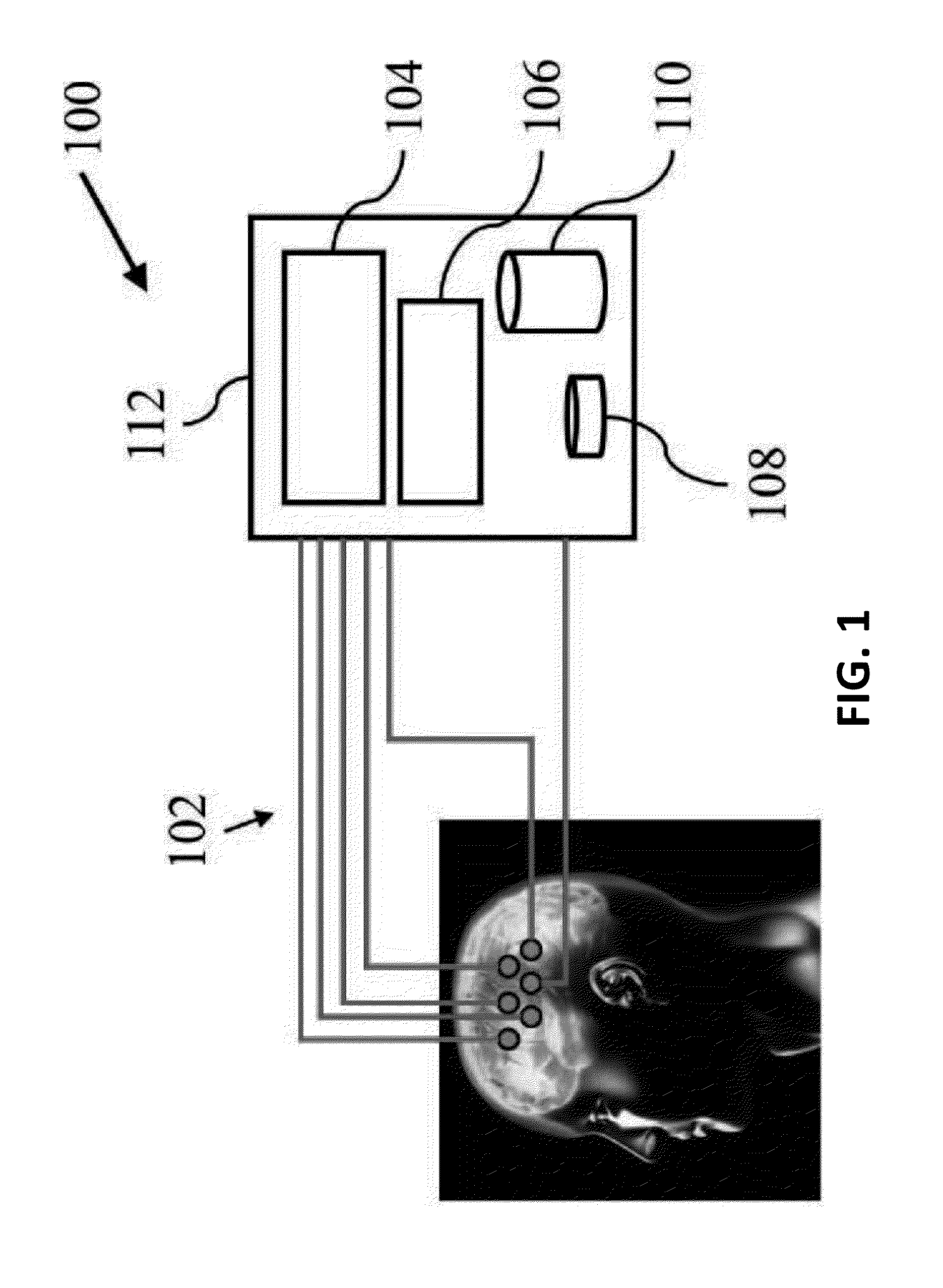 Seizure detection device and systems