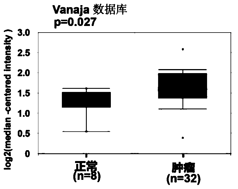 Application of Gankyrin protein as novel molecular marker in prognosis evaluation of prostate cancer