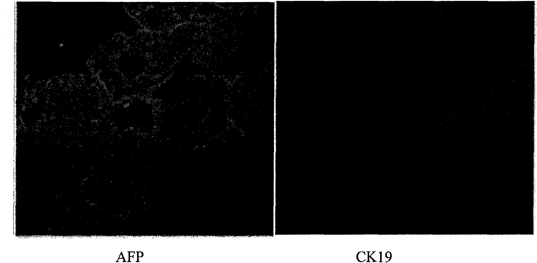 Method for preparing hepatic stem cell decorated by insulin gene and application and preparation thereof