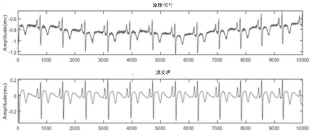 A method and device for extracting multi-scale features based on ECG