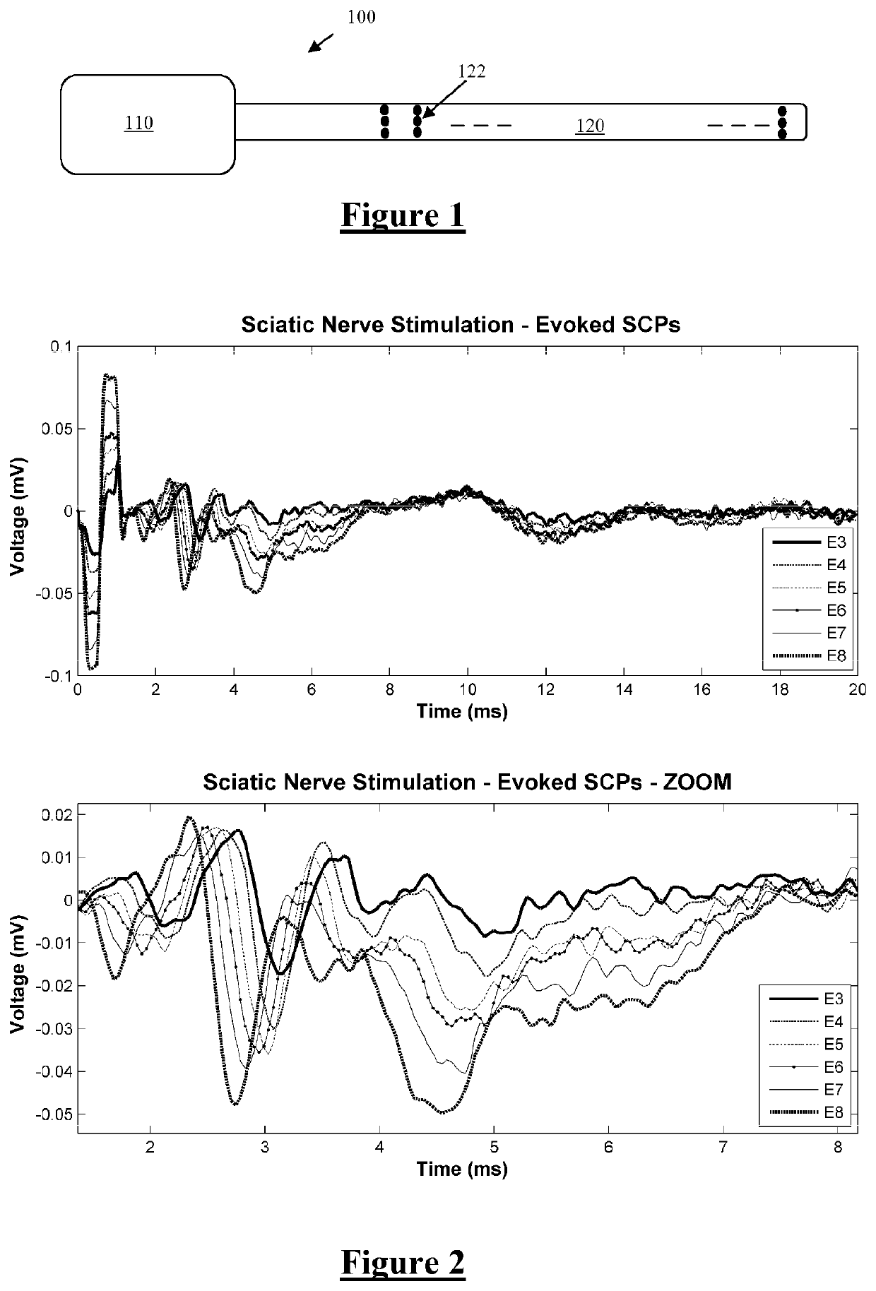 Method and apparatus for measurement of neural response