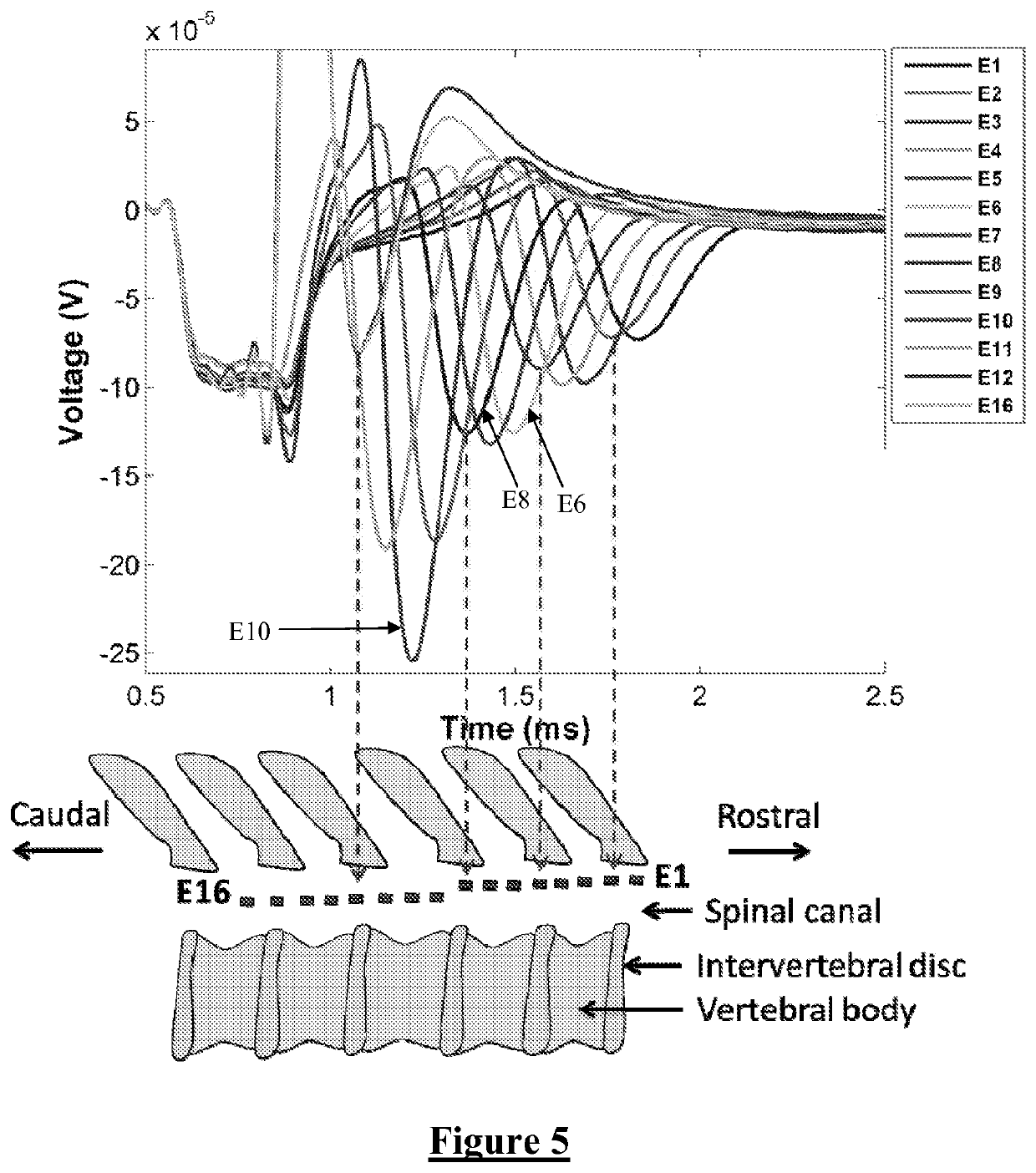 Method and apparatus for measurement of neural response