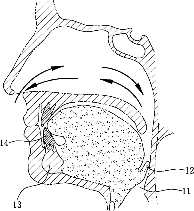 Snore-ceasing equipment