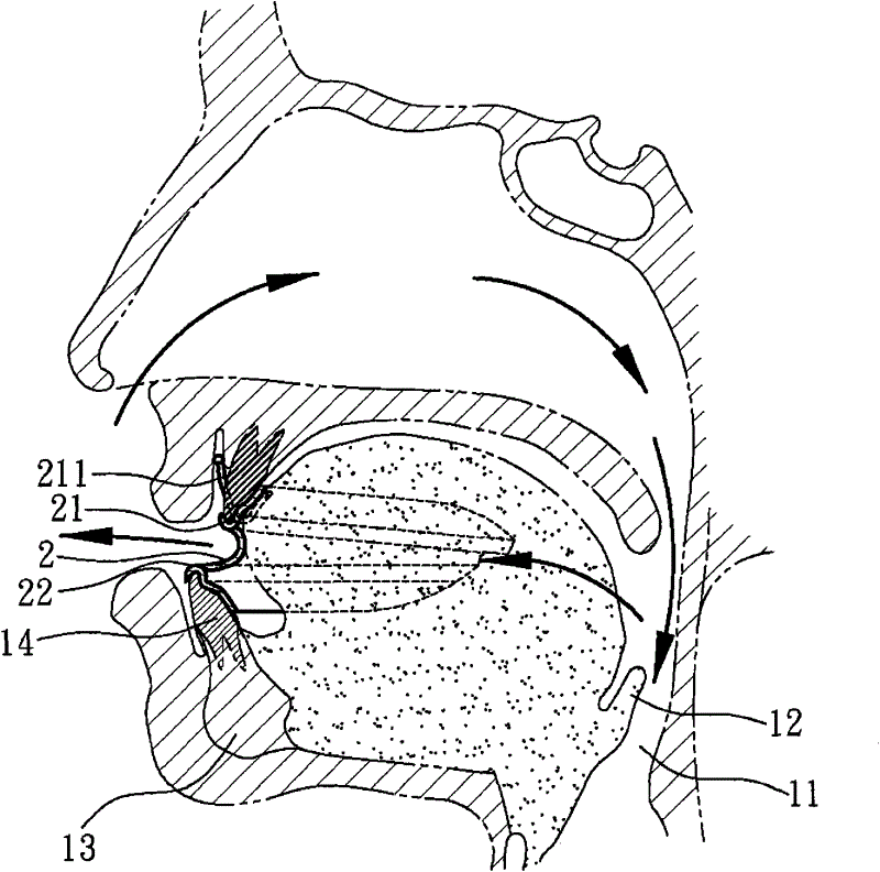 Snore-ceasing equipment