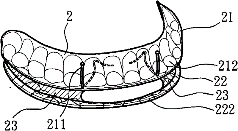 Snore-ceasing equipment