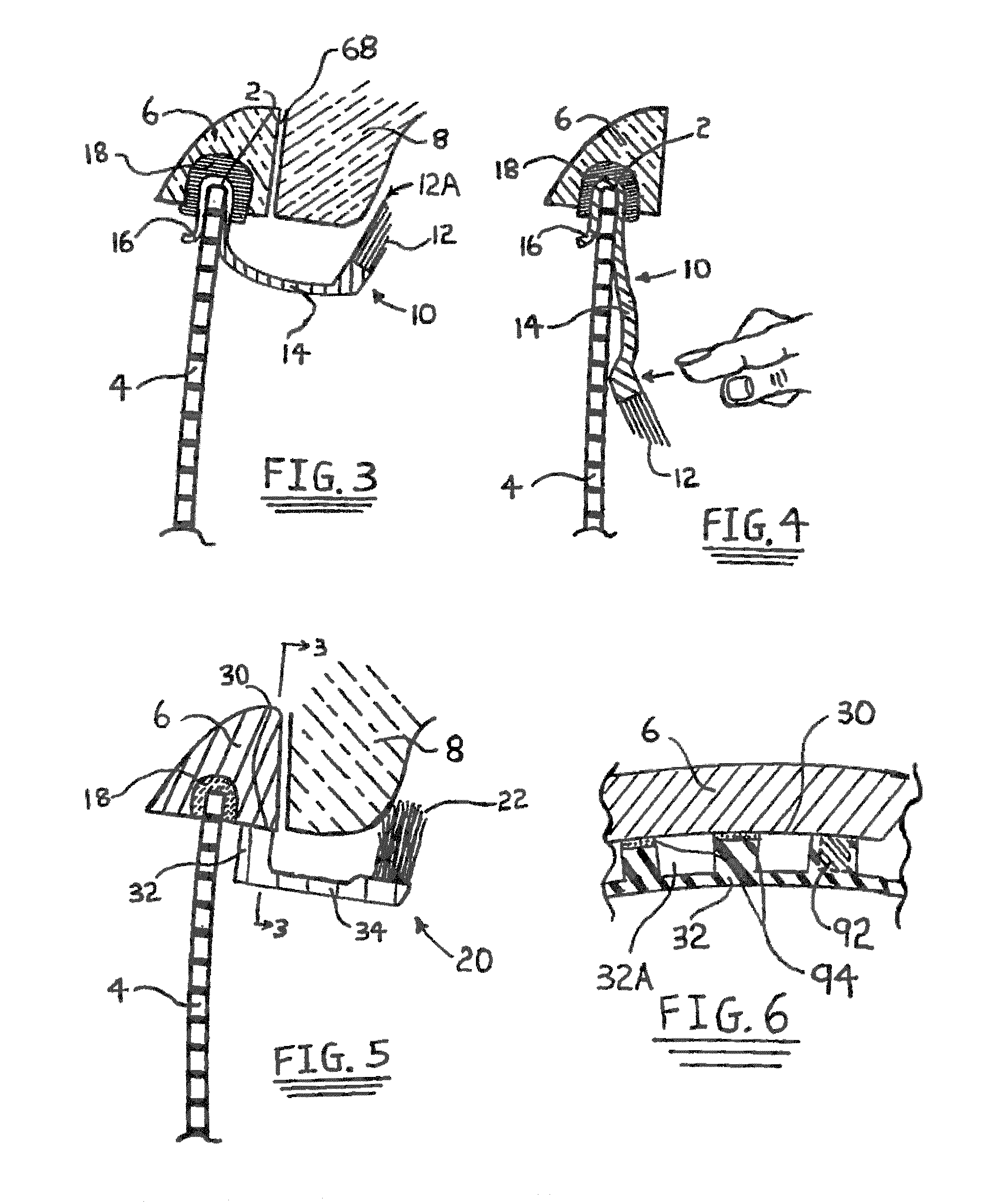 Automobile snow shield