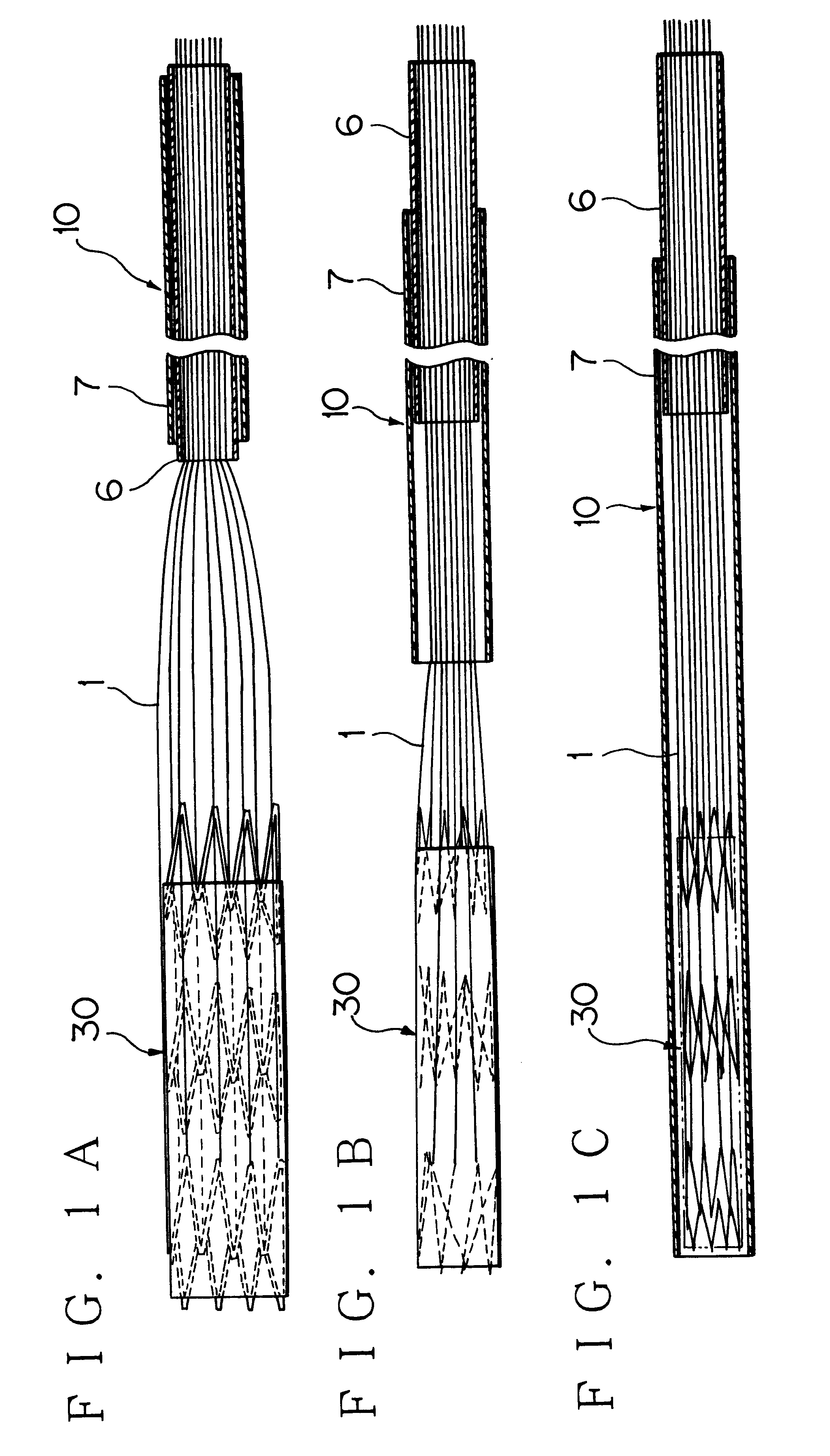 Stent (or stent graft) locating device