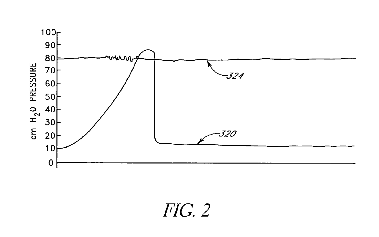 Attenuation device for use in an anatomical structure