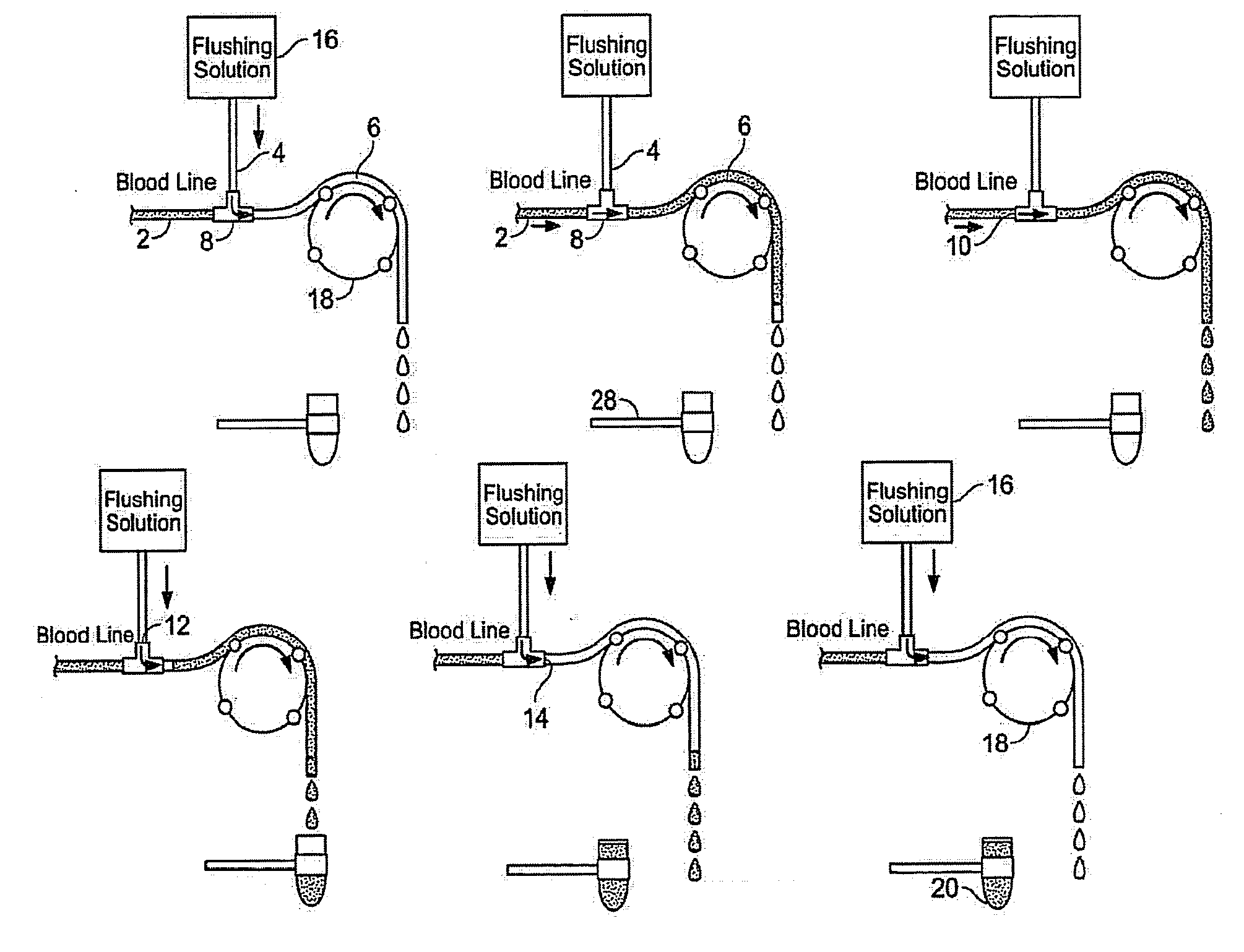 Automated blood draw system