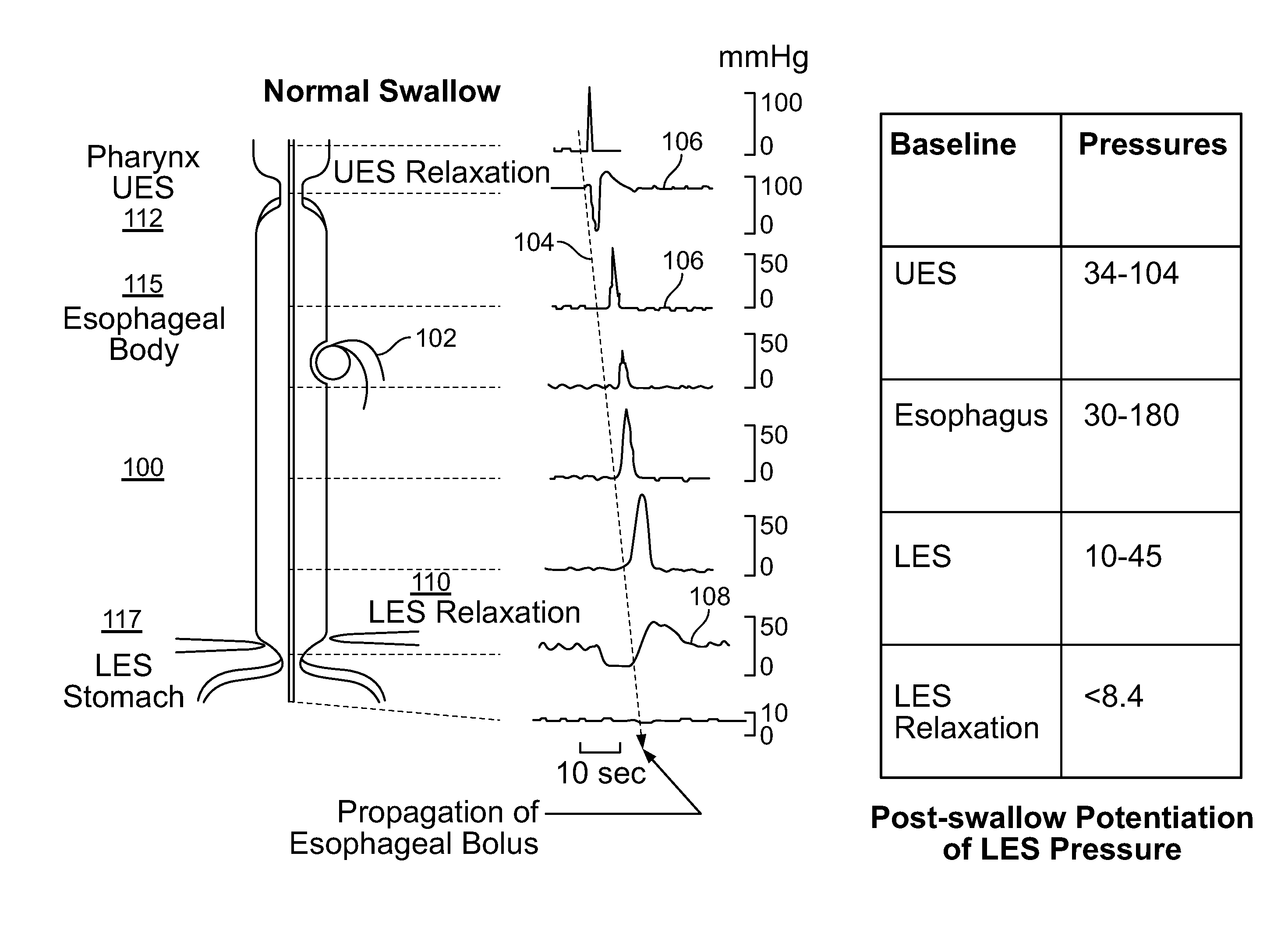 Device and implantation system for electrical stimulation of biological systems