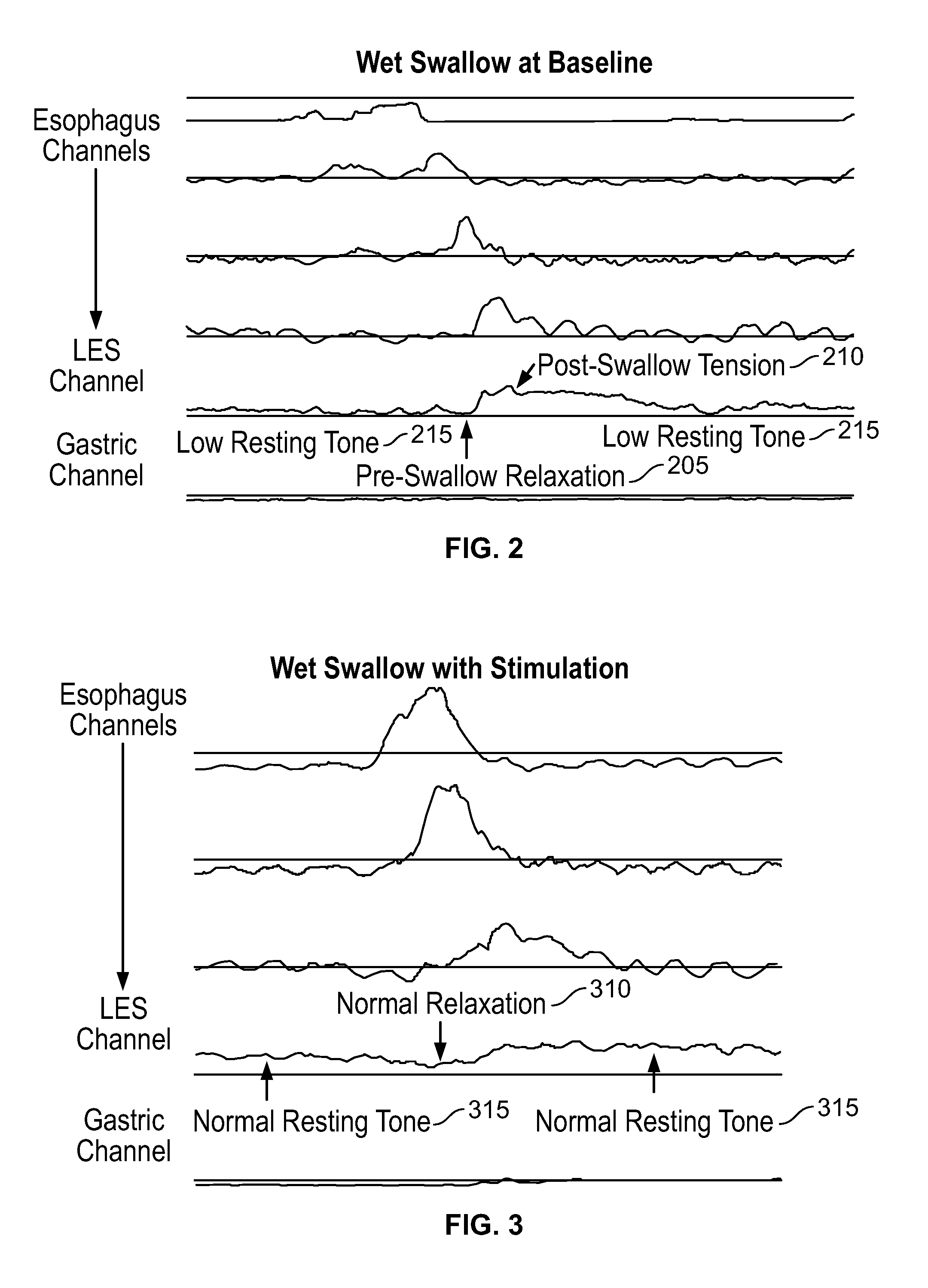 Device and implantation system for electrical stimulation of biological systems