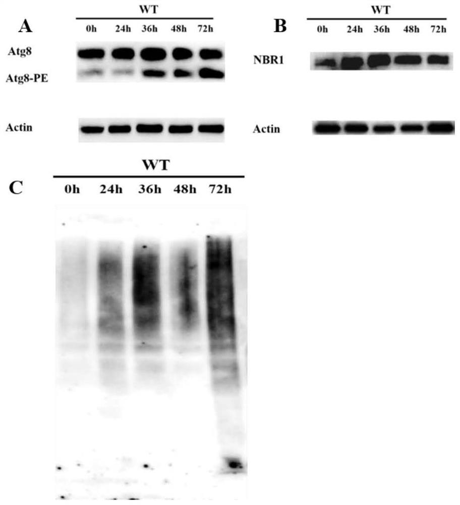 Application of autophagy gene of tomatoes in improvement on root-knot nematode resistance of plants