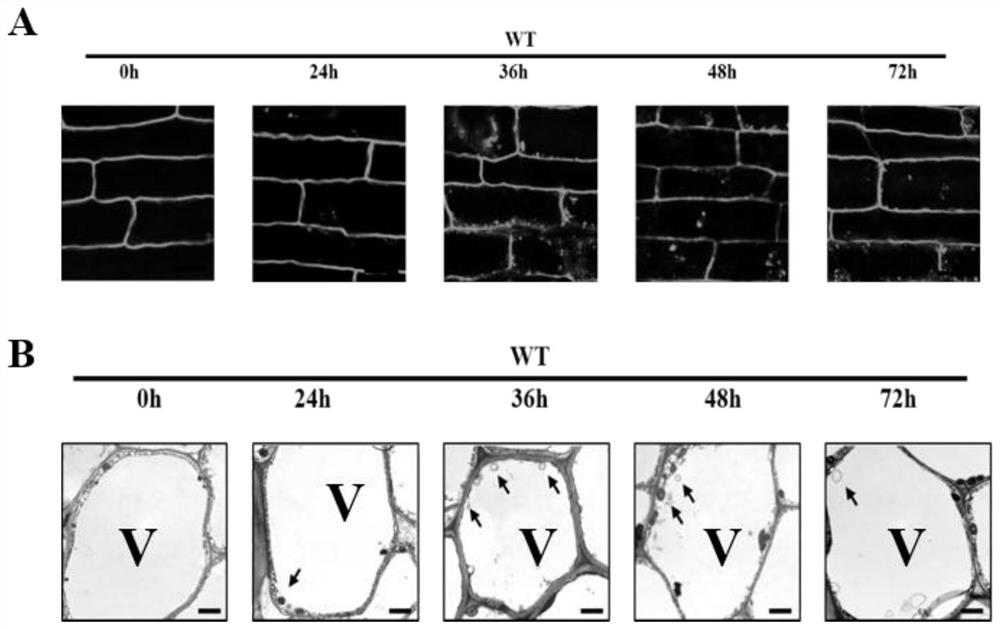 Application of autophagy gene of tomatoes in improvement on root-knot nematode resistance of plants