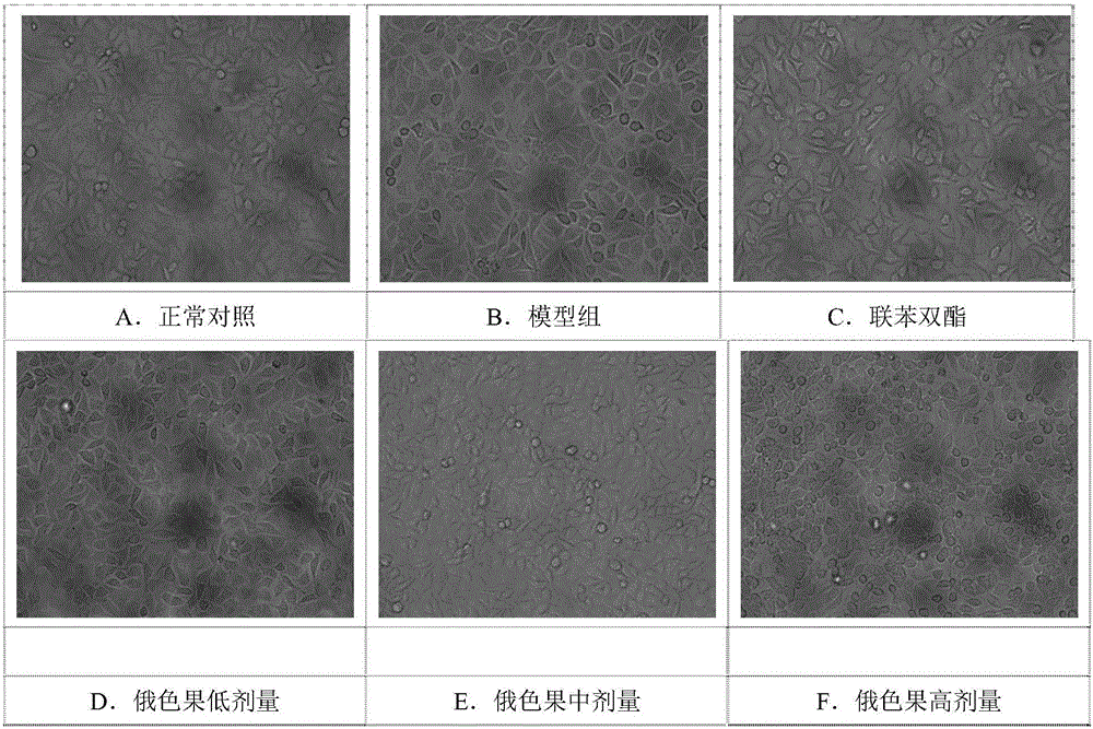 Application of fruits of Malus toringoides( Rehd .)Hughes. and Malus transitoria( Batal .)Schneid. and extract thereof in preparation of liver protecting medicine and healthcare food