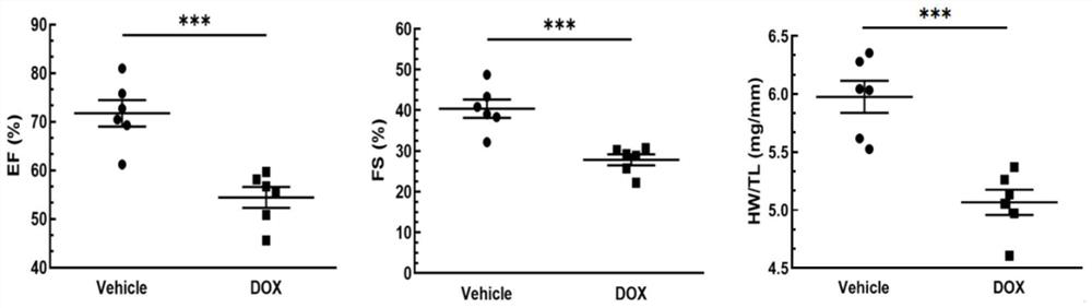 Application of CIRBP gene or protein coded by CIRBP gene in myocardial injury treatment