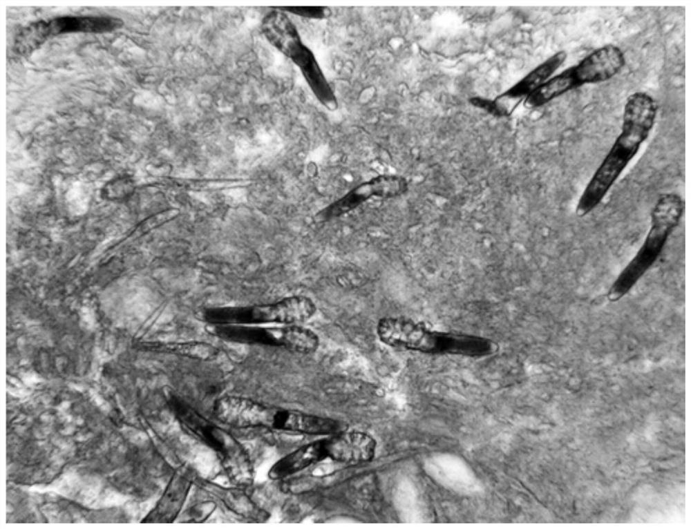 Clinical application of doxycycline hydrochloride dispersible tablets as drug for treating demodicidosis skin lesion