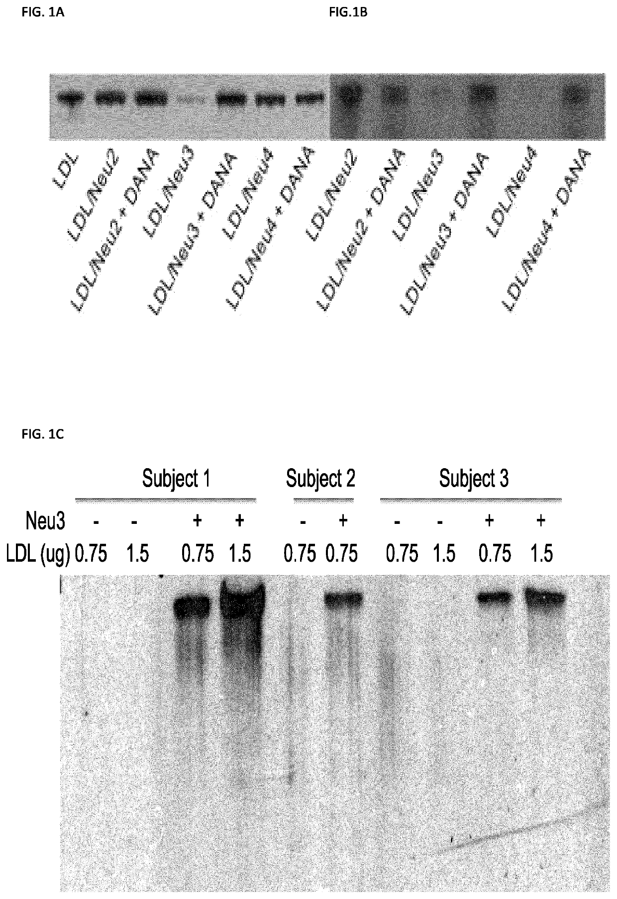 Methods of preventing or treating atherosclerosis with inhibitors of specific isoenzymes of human neuraminidase