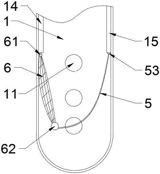 Anti-blockage drainage pipe for general surgery department