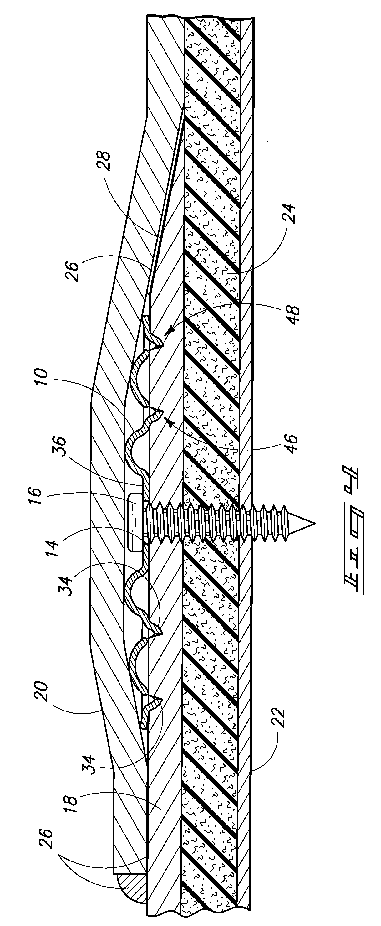 Roofing Membrane Retainer