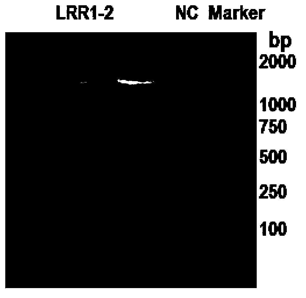 Fusion protein containing leucine-rich repetitive sequence, and preparation method and application thereof