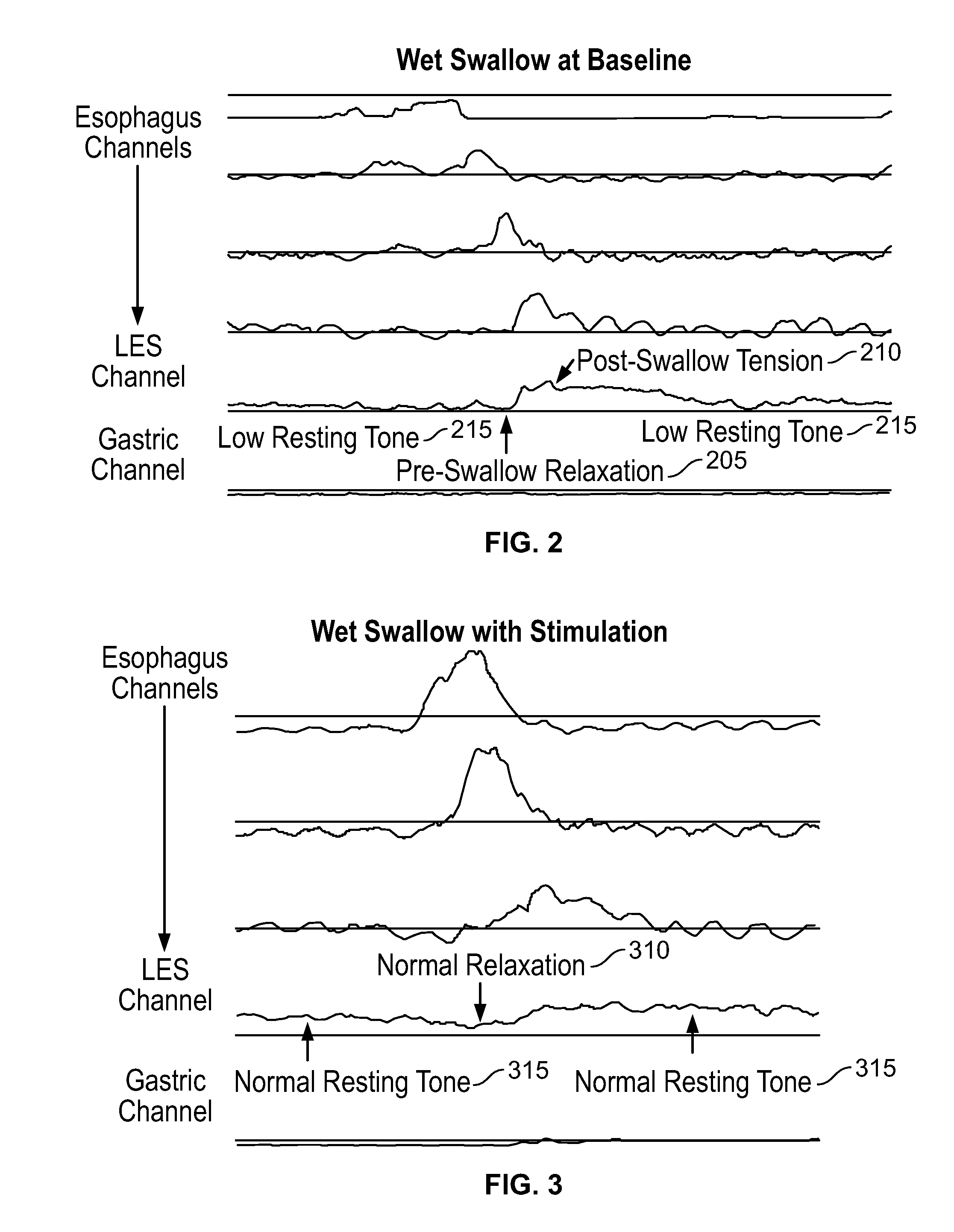 Device and Implantation System for Electrical Stimulation of Biological Systems