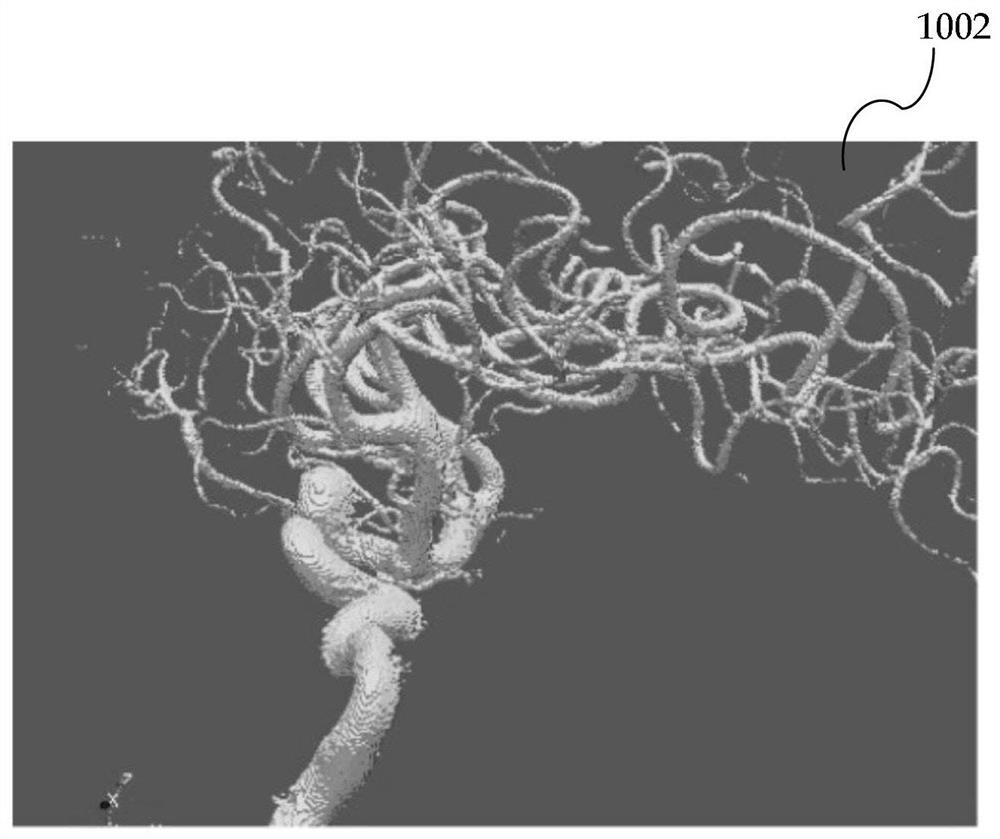 Isolation of aneurysms from parent vessels in volumetric image data