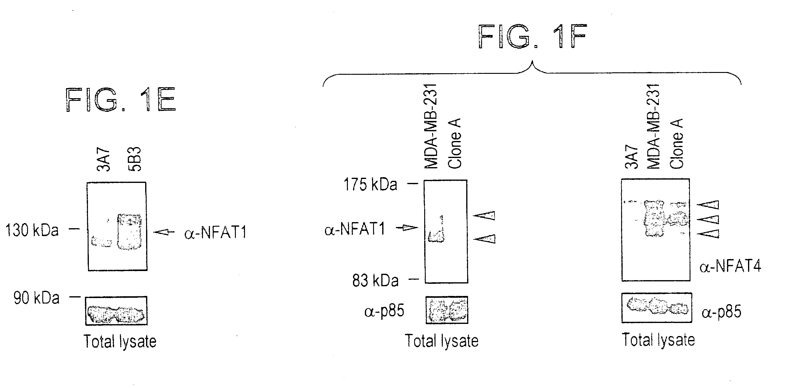 NFAT transcription factors in tumor progression