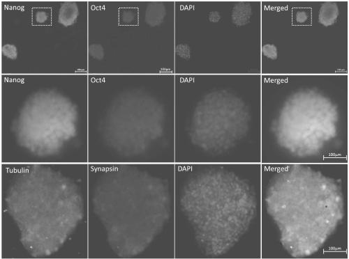 Human-adipose derived adult stem cell-derived neuronal precursor cells and preparation method therefor and application of neuronal precursor cells