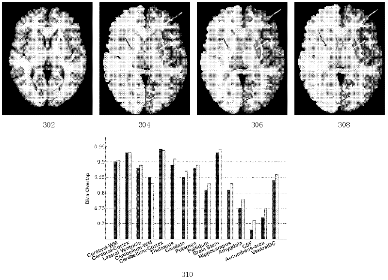 Magnetic resonance image brain structure automatic dividing method based on statistics multi-map registration optimization