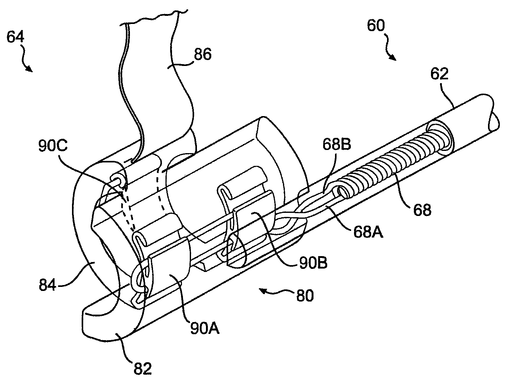 Obstructive sleep apnea treatment devices, systems and methods