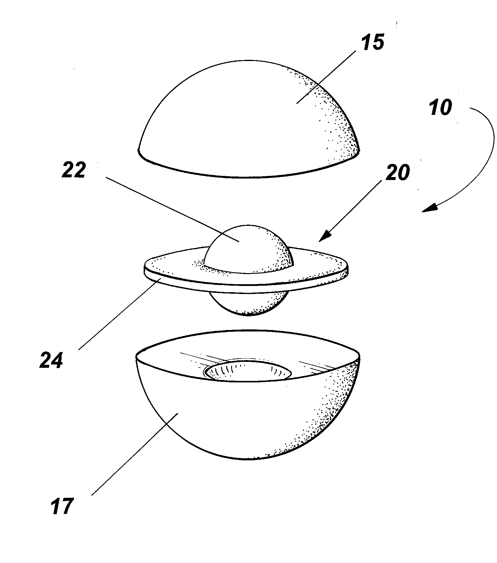 Spinal interbody device