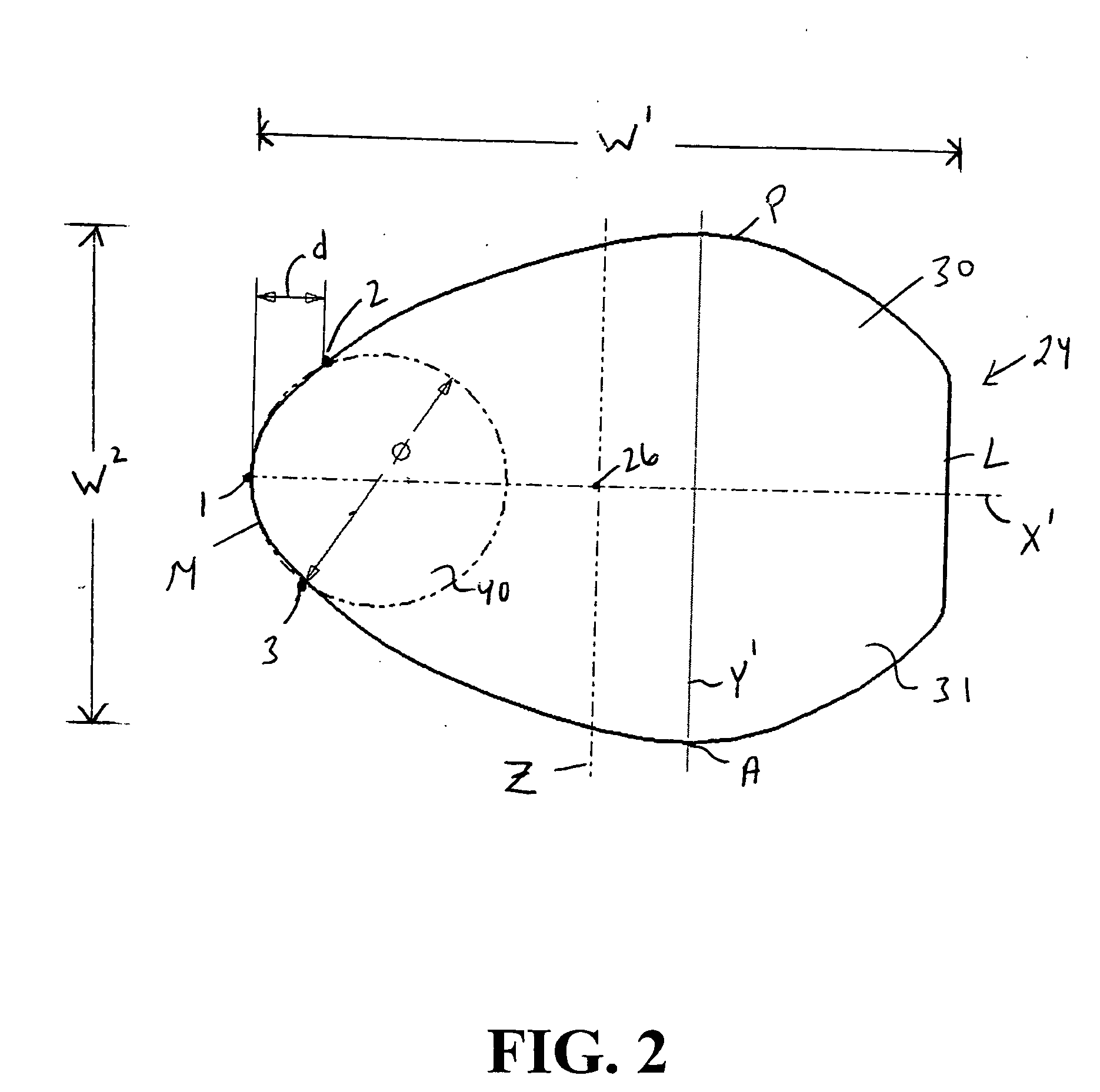 Femoral implant for hip arthroplasty