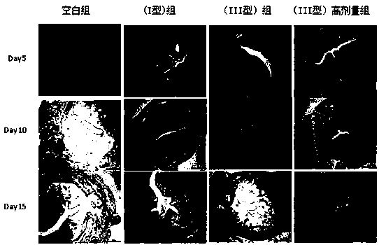 Composition for promoting postoperative wound healing and preparation method thereof