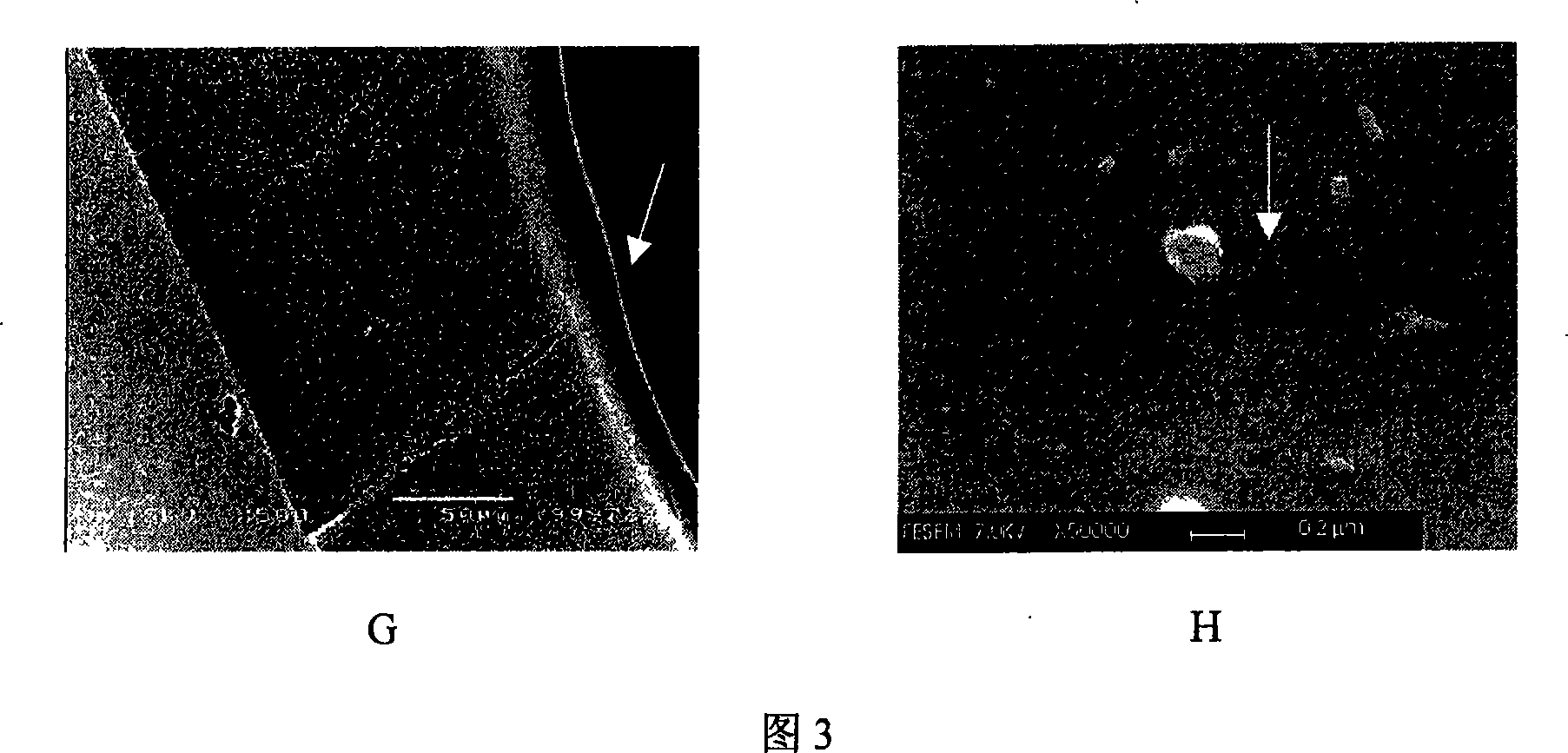 Method for preparing porous separation membrane