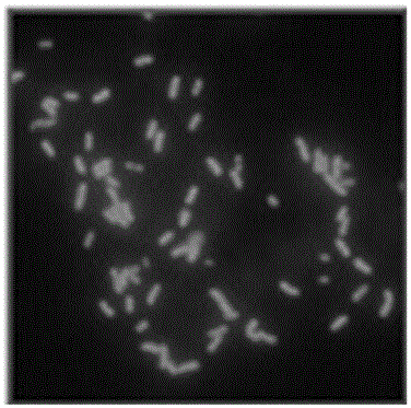 Fluorescence in situ hybridization detection kit for detection of Mycobacterium tuberculosis infection