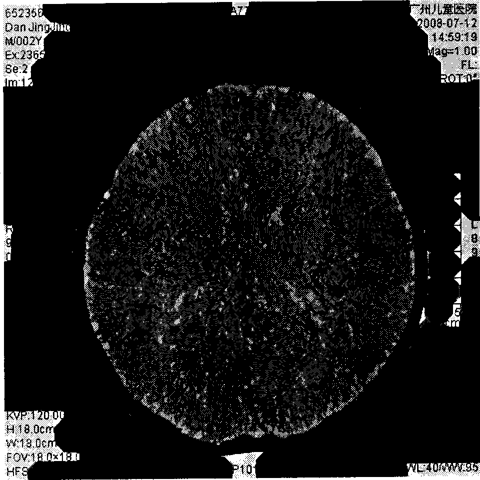 Analysis method for infant brain medical computer scanning images and realization system