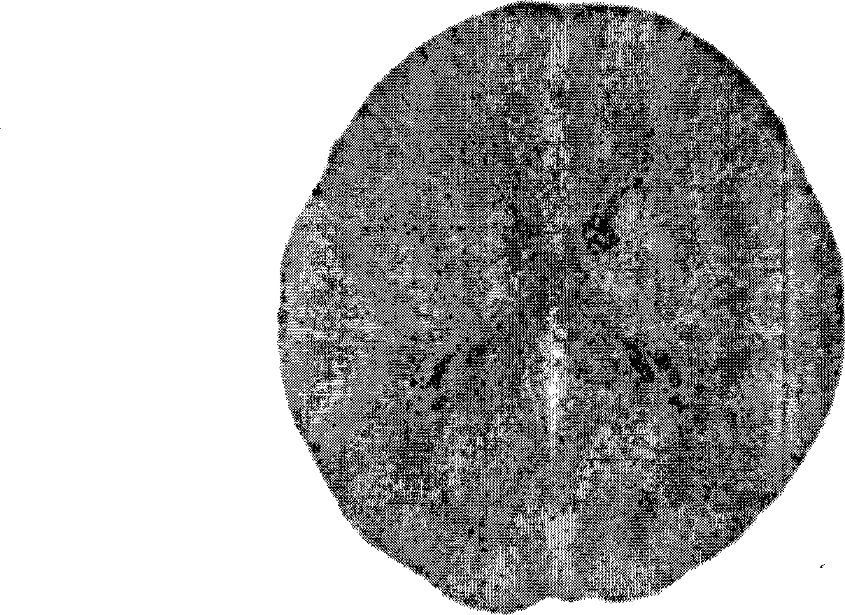 Analysis method for infant brain medical computer scanning images and realization system