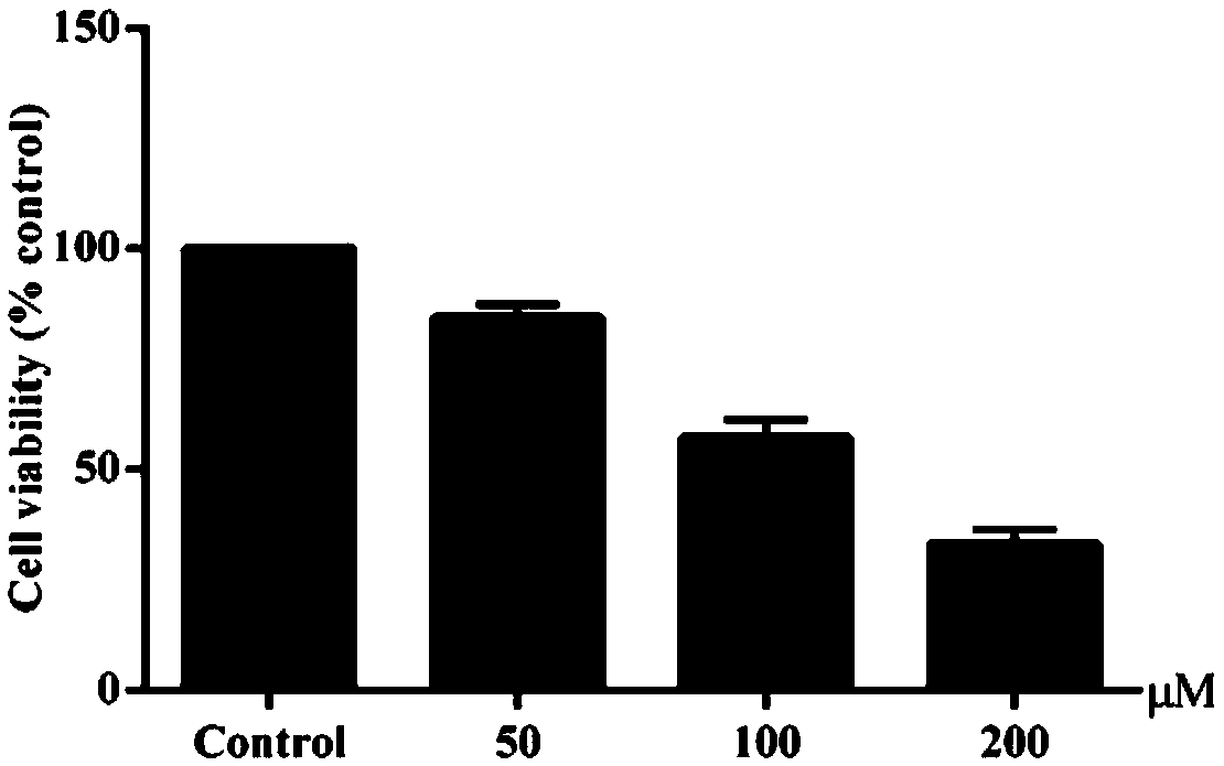 Anti-liver cancer health product containing isoalantolactone