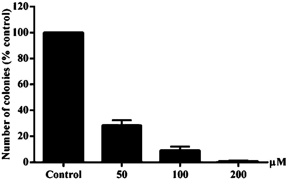 Anti-liver cancer health product containing isoalantolactone