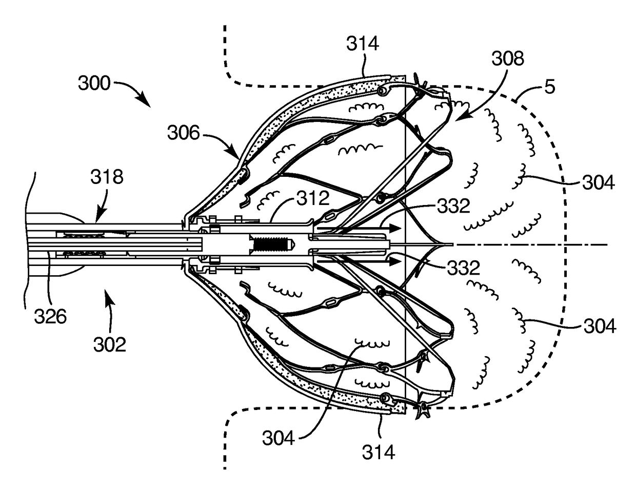 Medical device for modification of left atrial appendage and related systems and methods